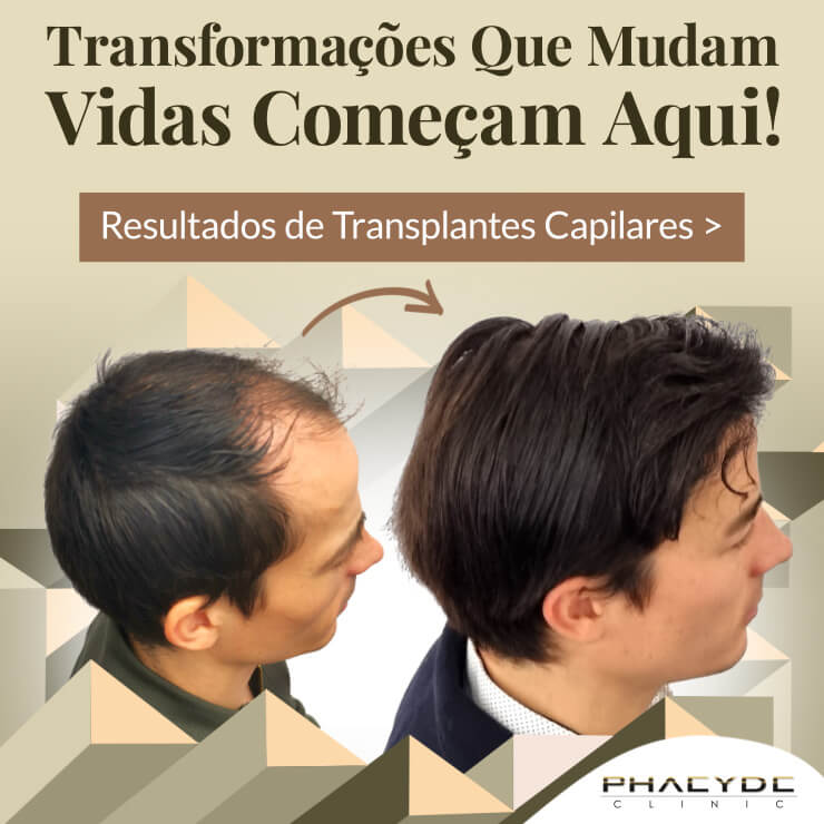 no. 1 transplante de cabelo