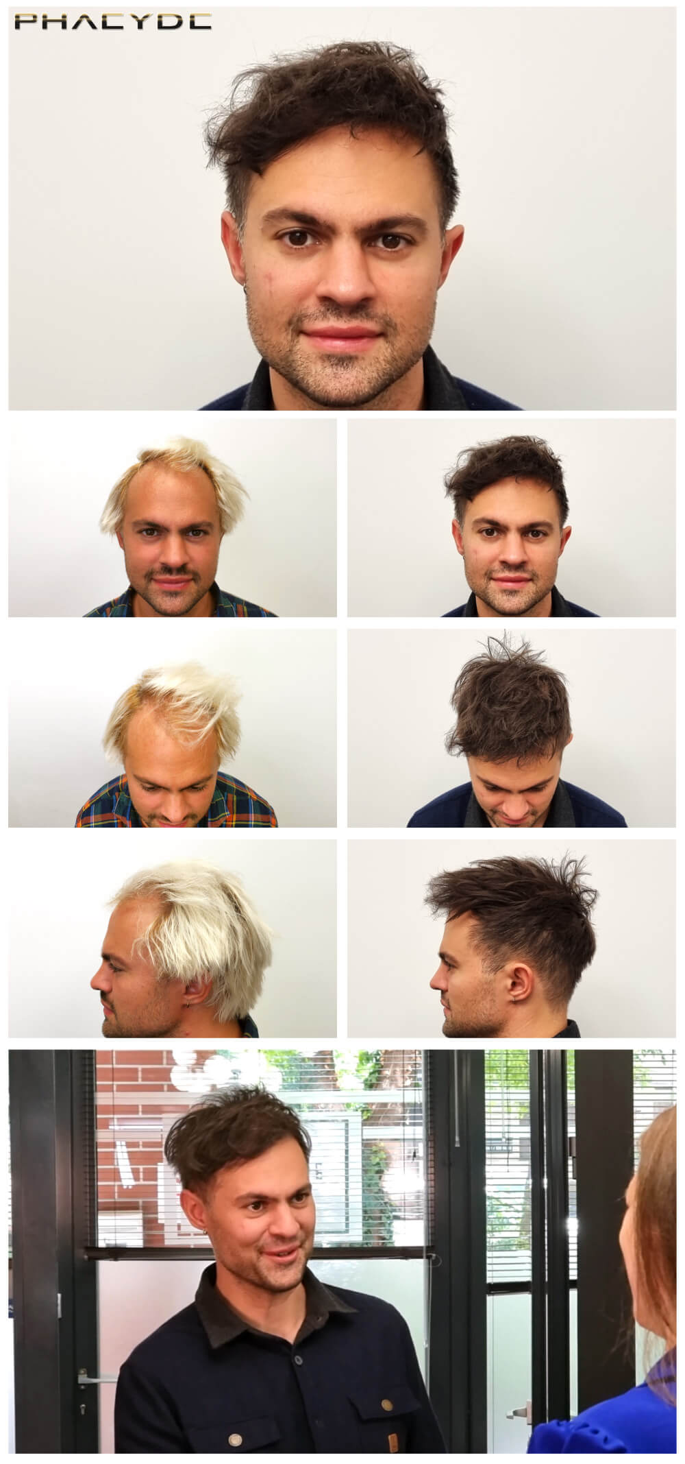 Máté – 2200+ Enxertos